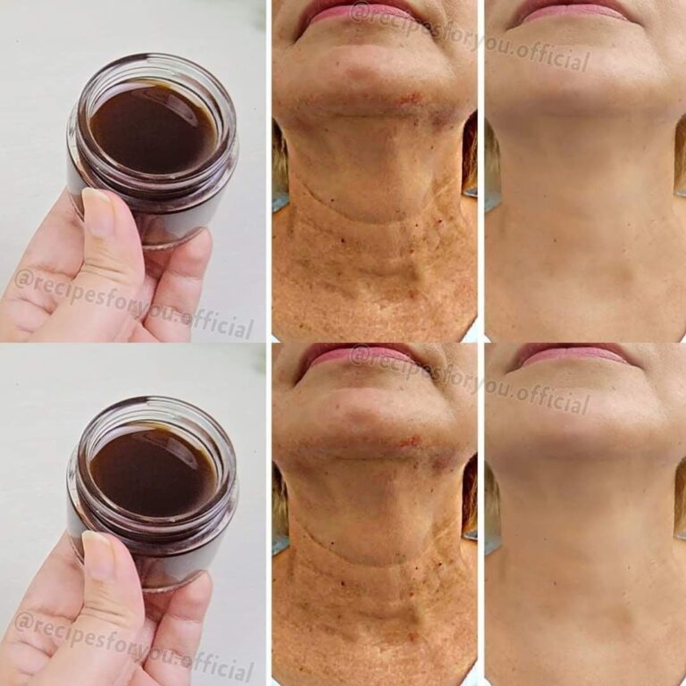 466515755 122208040298067439 566829785193288475 N