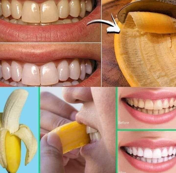 468099973 500092343069576 6328770575210515818 N