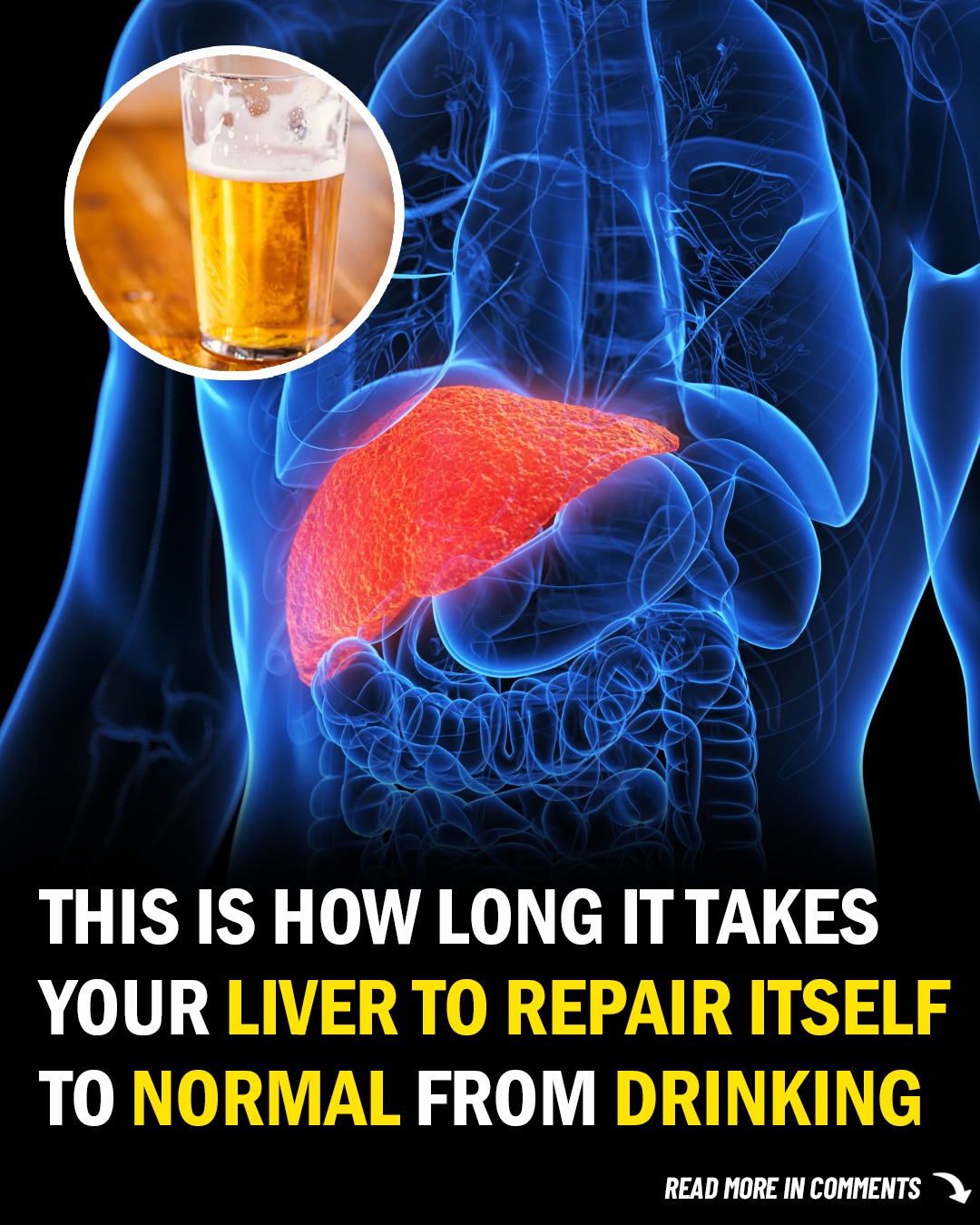 508559898 1173723364798270 8727057147075714770 N